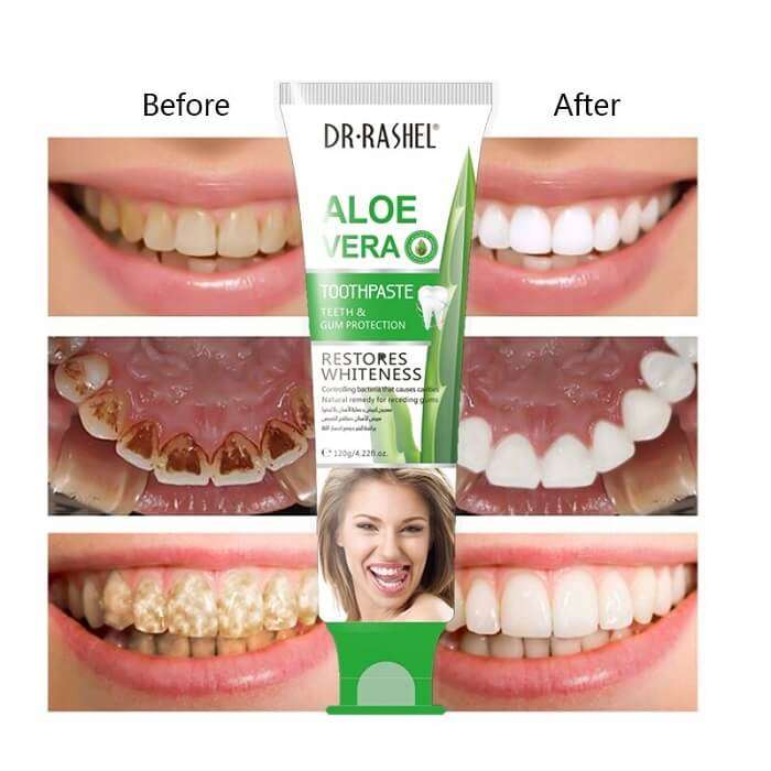 Dr. Rashel Aloe Vera Teeth And Gum Protection ToothPaste In AjmanShop 