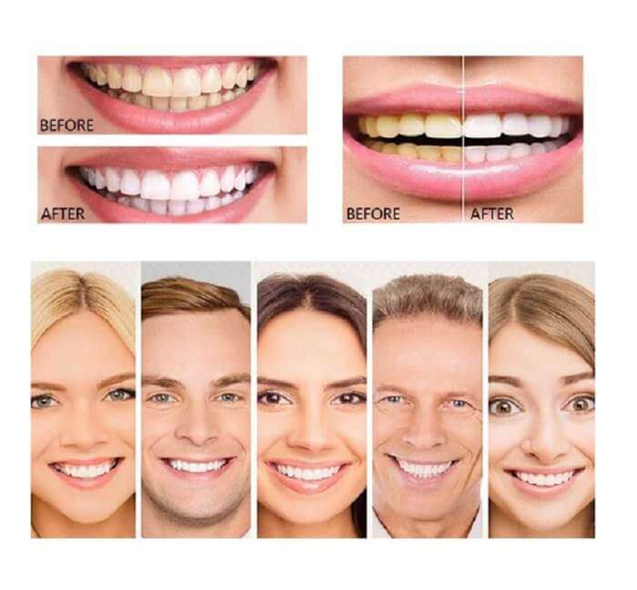 Dr. Rashel Vitamin C Teeth & Gum Protection ToothPaste in AjmanShop