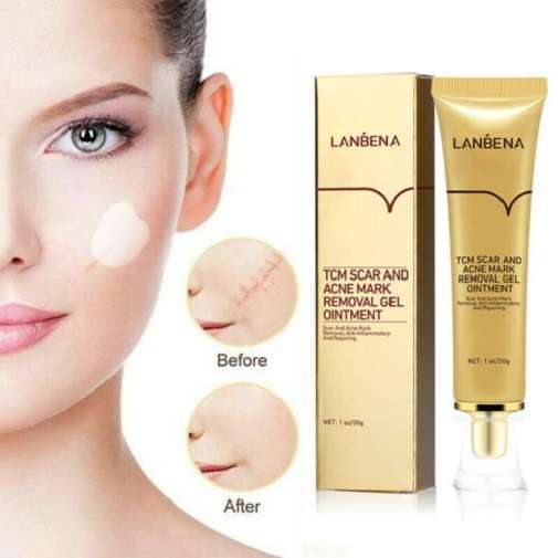 Lanbena Ance Scar Removal Gel Ointment in AjmanShop 