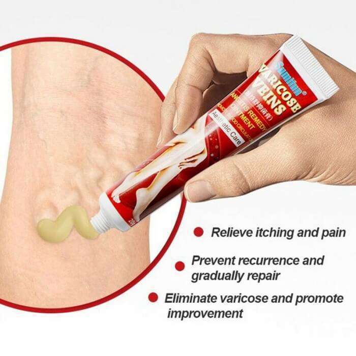  Varicose Veins Angiitis Ointment Herbal Cream In AjmanShop