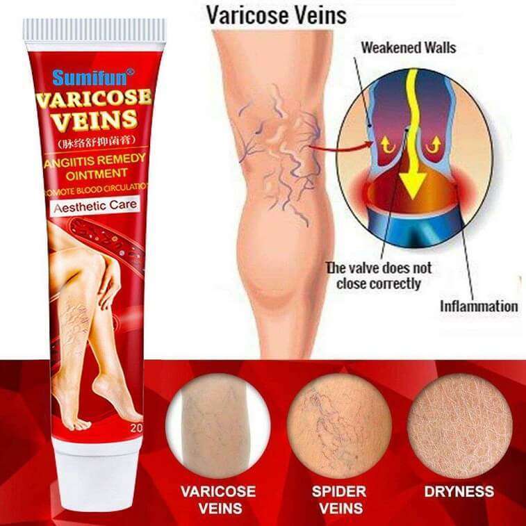 Varicose Veins Angiitis Ointment Herbal Cream- AjmanShop